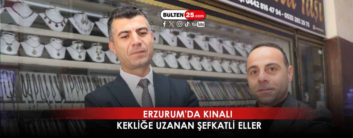 ERZURUM'DA KINALI KEKLİĞE UZANAN ŞEFKATLİ ELLER