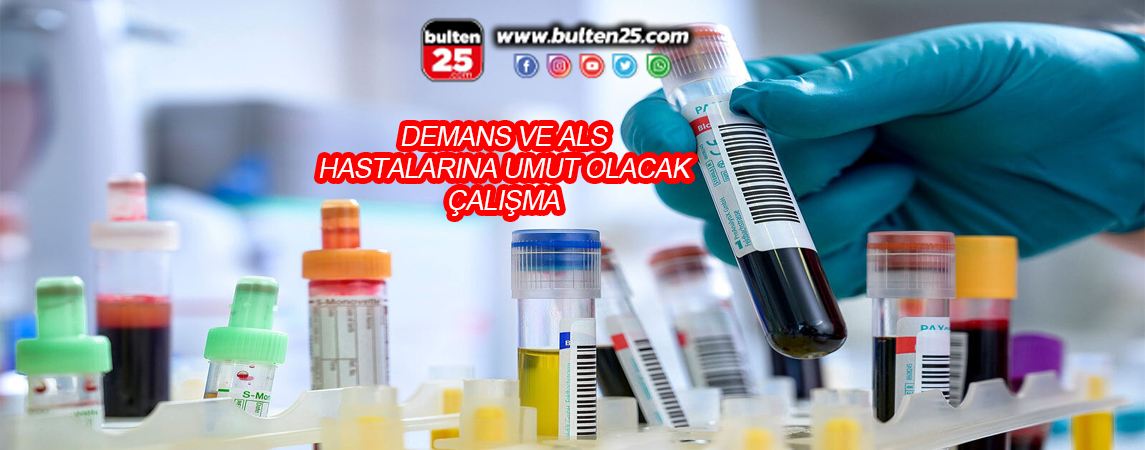 DEMANS VE ALS HASTALARINA UMUT OLACAK ÇALIŞMA