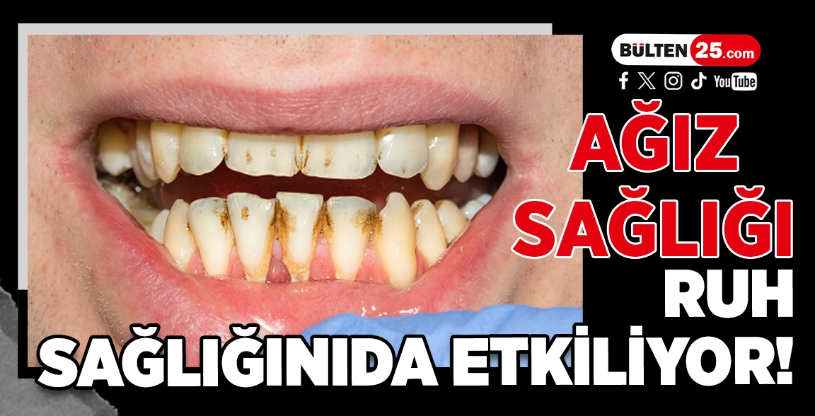 AĞIZ SAĞLIĞI, RUH SAĞLIĞINIDA ETKİLİYOR!