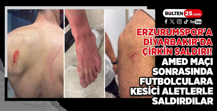 ERZURUMSPOR'A DİYARBAKIR'DA ÇİRKİN SALDIRI! AMED MAÇI SONRASINDA FUTBOLCULARA KESİCİ ALETLERLE SALDIRDILAR