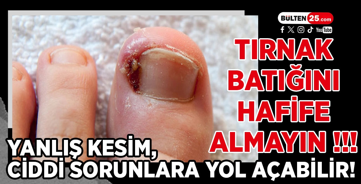 TIRNAK BATIĞINI HAFİFE ALMAYIN: YANLIŞ KESİM, CİDDİ SORUNLARA YOL AÇABİLİR!